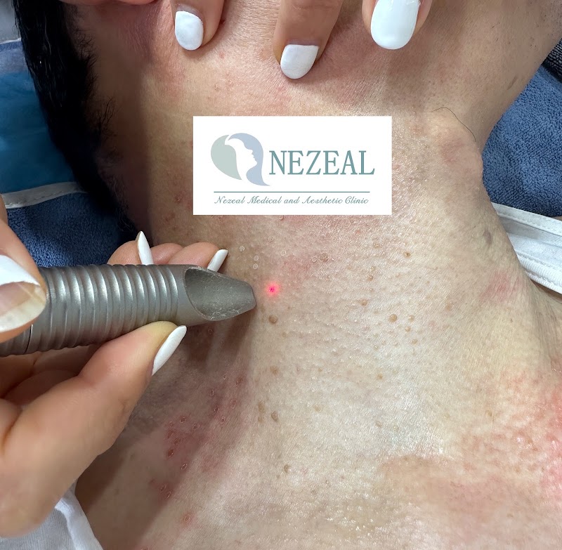 Nezeal Medical and Aesthetic Clinic