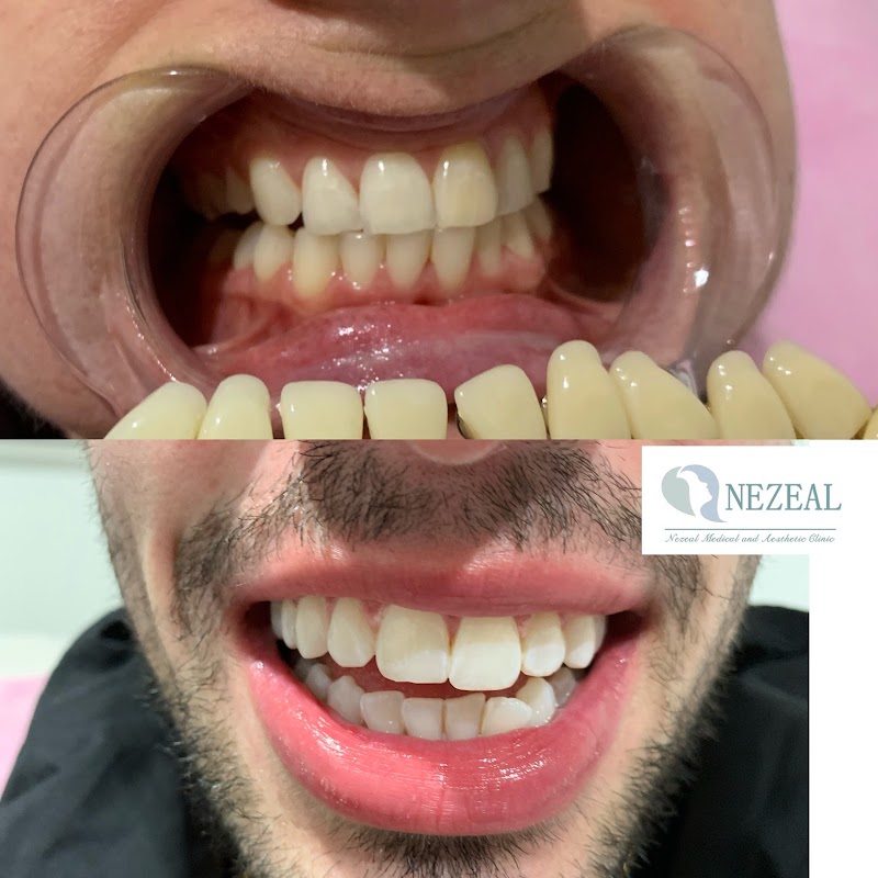 Nezeal Medical and Aesthetic Clinic