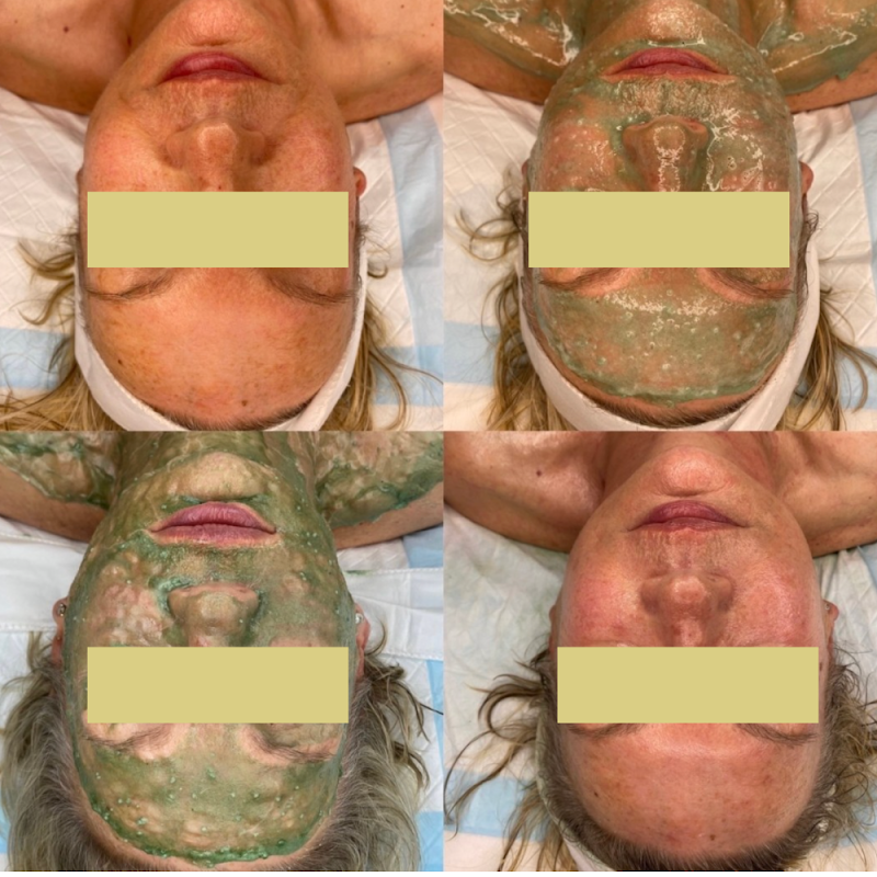 Richmond Skin & Laser Clinic