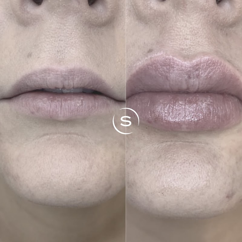 SKIN CLUB - Cosmetic Doctors